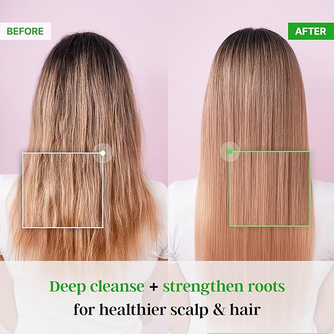 Premium TS Shampoo 10.14 fl oz / 300g for hair loss prevention, Anti-Thinning Biotin Shampoo, Korean shampoo, Natural Daily Routine