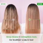 Premium TS Shampoo 10.14 fl oz / 300g for hair loss prevention, Anti-Thinning Biotin Shampoo, Korean shampoo, Natural Daily Routine