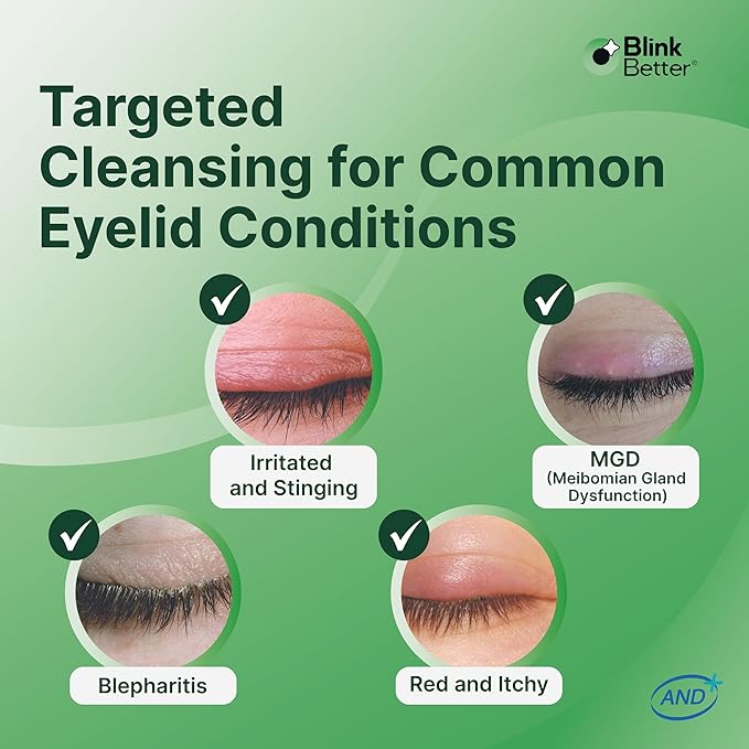 BetterLids Eyelid Cleansing Gel – Gentle Centella & Tea Tree Extract Cleanser – Refreshes & Cleanses for Daily Eyelid Care – Preservative-Free – 1.06 oz