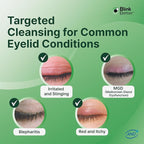 BetterLids Eyelid Cleansing Gel – Gentle Centella & Tea Tree Extract Cleanser – Refreshes & Cleanses for Daily Eyelid Care – Preservative-Free – 1.06 oz