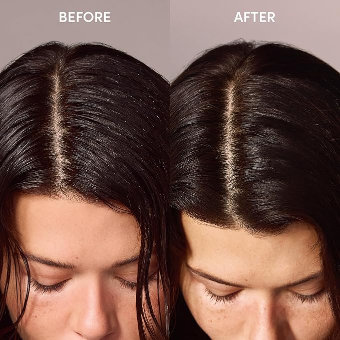 OUAI Super Travel Size Dry Shampoo - Volumizing Dry Shampoo - Absorbs Oil, Dirt & Sweat - Blends Seamlessly into Hair with Zero Residue & Enriched with a Long-Lasting Scent - Cape Town (2 oz)