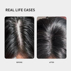 0.9% KX-826 KINTOR Hair Growth Spray,Strengthen Hair Nourish Hair follicles,Hair Care Products for Sparse Hair and Oily Hair Men&Women,180ml,Pro