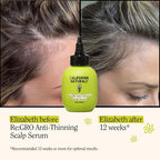 California Naturals Women's Re: Gro Anti-Thinning Scalp Serum, 5% Capixyl with Biotin, Caffeine & Castor and Rosemary Oil, Non-Sticky Cooling Formula, Vegan & Cruelty Free, 3oz