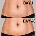 AOAO Stretch Mark Oil for Pregnancy and Body Oil for Pregnant Women, Morocco Nut Oil Help for Scars and Stretch Marks Removal and Prevention, Repair, Firming & Smoothing Fine Lines - 100ml/1pack