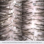 BONDIBOOST Anti-Dandruff Repair Shampoo; Soothe and Revitalize Your Scalp - Relief for Itchy, Flaky, and Irritated Scalp, Promotes Healthy Hair and Long-Lasting Comfort