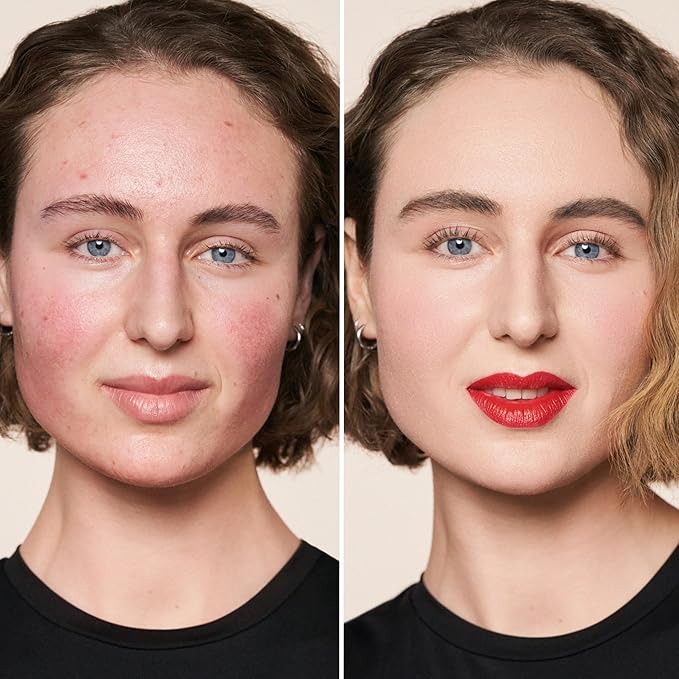 M. Asam Magic Finish Make-Up Mousse (1.01 Fl Oz) – 4in1 Primer, Foundation, Concealer & Powder With Buildable Coverage, Hides Redness And Dark Spots, Vegan, For Light To Medium Skin Tones