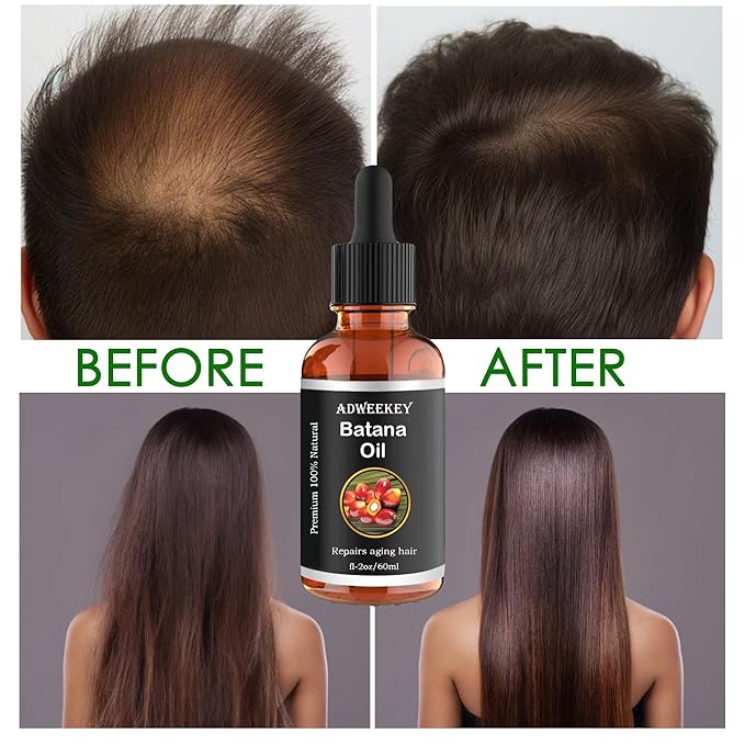 Organic Batana Oil for Hair Growth, 100% Pure , Promotes Hair Wellness for Men & Women, Enhances Hair & Skin Radiance (2.0 Oz)