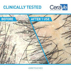 CeraVe Hydrating Anti Dandruff Shampoo, 1% Pyrithione Zinc Dandruff Treatment With Ceramides, Niacinamide & Hyaluronic Acid, Helps Eliminate Flakes & Provides Itchy Scalp Relief, Sulfate Free, 12 Oz