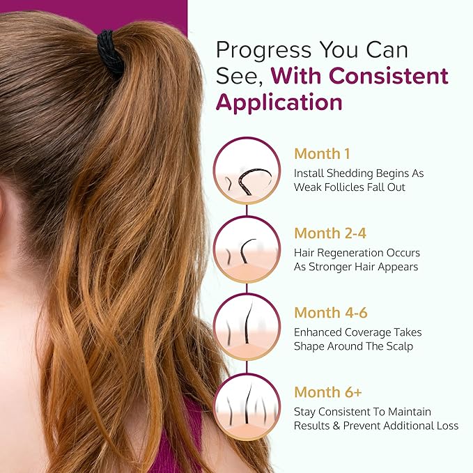 Minoxidil for Women 5% Foam - Helps Restore Top of Scalp Hair Loss and Support Hair Growth for Women, Regrowth with Unscented Topical Treatment for Thinning Hair (5% Foam 4-Month Supply)