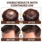 Root Activator Batana Oil Hair Growth Shampoo: Natural Hair Loss Shampoo for Thinning Hair for Women and Men - Daily Hair Care at Home - 10.1 fl.oz