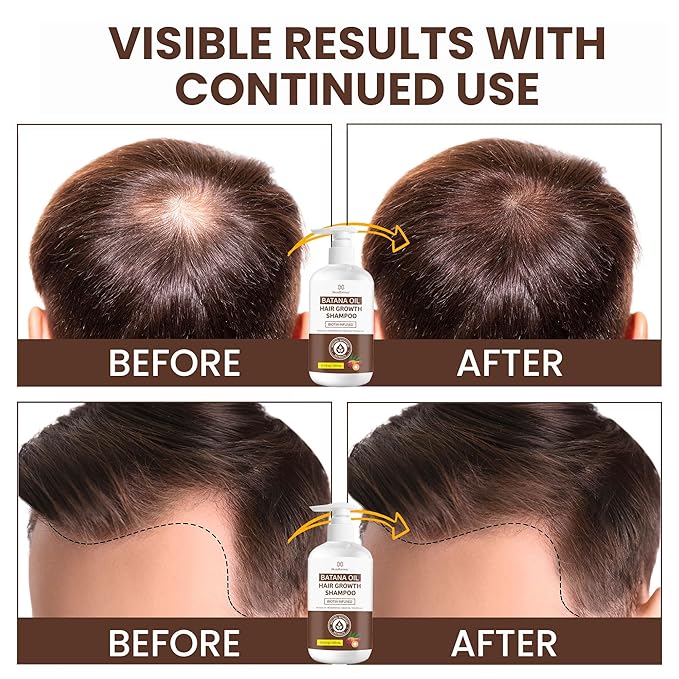 Root Activator Batana Oil Hair Growth Shampoo: Natural Hair Loss Shampoo for Thinning Hair for Women and Men - Daily Hair Care at Home - 10.1 fl.oz