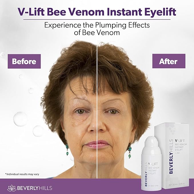 Beverly Hills V-Lift Instant Eye Lift and Eye Tuck Bee Venom Serum for Puffy Eyes, Dark Circles, Wrinkles, and Under Eye Bags Treatment for Women and Men | 30mL (120 Day Supply)