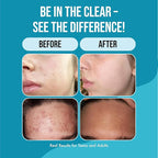 Teenology Teen Shampoo – Avoid Acne Breakouts, Non-Comedogenic, For Dry & Oily Scalps, Sulfate & Paraben Free, Natural Extracts, for Clear Skin & Healthy Hair, 16 oz – (Blueberry Pomegranate Cucumber)