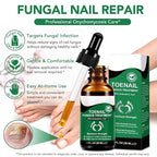 2Pack Toenail Treatment with 25% Undecylenic Acid, Nail Renewal, Promotes Nail Health,Enrich jojoba oil and vitamin E nourish the nail and & Skin,Safe & Gentle Repairing Damaged Nails