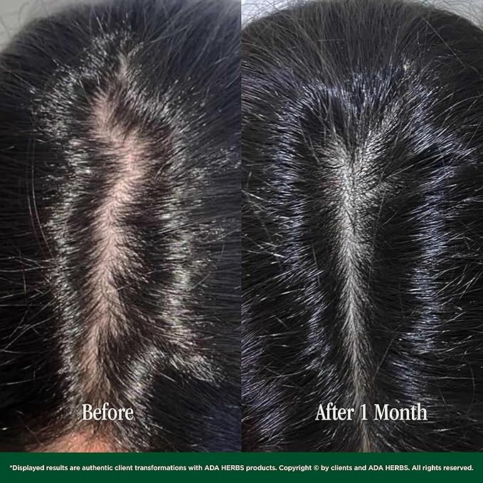 Hair Oil Mask Pre-Wash & Overnight 100% Natural Hair Growth Oil with Cold Pressed Argan, Castor, Jojoba, Rosemary, Vitamin E (8.45 Fl Oz)