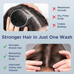 Nora Ross Garlic Extract Hair Strengthening Shampoo – Thickening Shampoo for Women and Men with Normal to Dry, Thinning Hair – All Natural Anti-Dandruff and Scalp Cleanser with Rosemary – 32oz