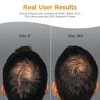 Viviscal Men's Hair Growth Supplements for Thicker Fuller Hair, Clinically Proven Collagen Complex, 60 Tablets 1 Month Supply