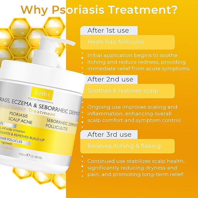 Anti Fungal Psoriasis Conditioner for Psoriasis, Eczema & Seborrheic Dermatitis | With DHT Blockers, Mineral Complex & Tea Tree Oil | Soothes Dry Itchy Scalp & Supports Hair Growth for Men & Women