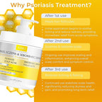 Anti Fungal Psoriasis Conditioner for Psoriasis, Eczema & Seborrheic Dermatitis | With DHT Blockers, Mineral Complex & Tea Tree Oil | Soothes Dry Itchy Scalp & Supports Hair Growth for Men & Women