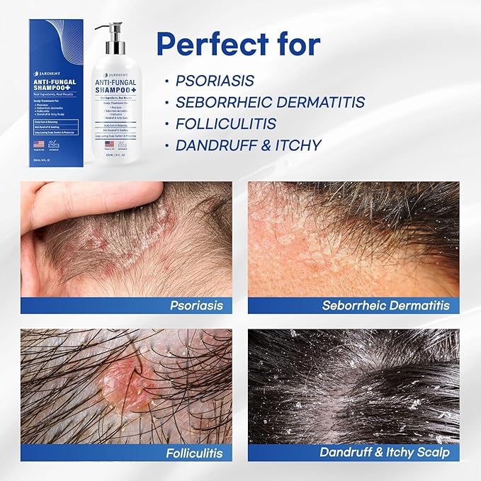 Dandruff Shampoo (8 Fl Oz (Pack of 1))