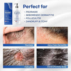 Dandruff Shampoo (8 Fl Oz (Pack of 1))