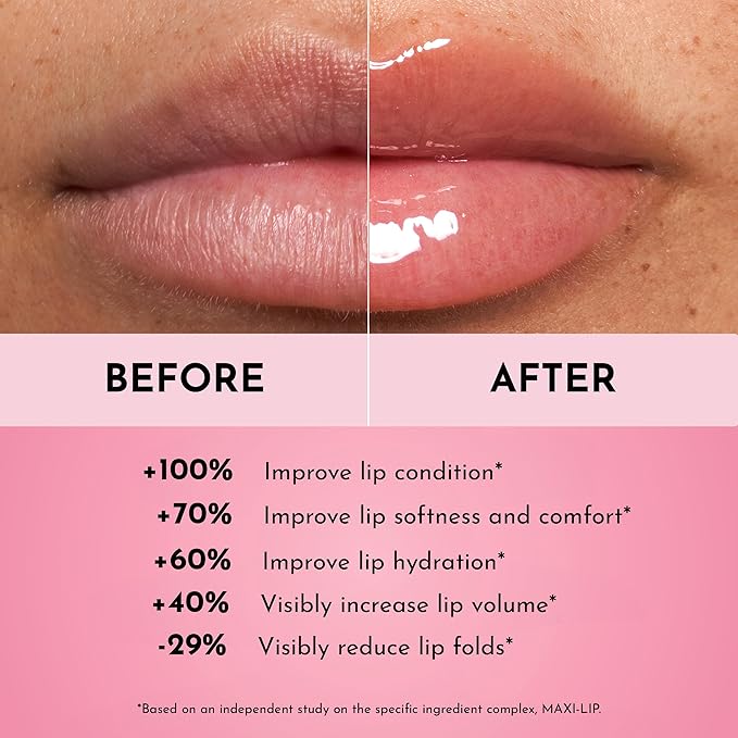 Lawless Women's Forget The Filler Lip Plumper Line Gloss - Queen Size, Cherry Vanilla, Red, 0.19 Fl Oz (Pack of 1)