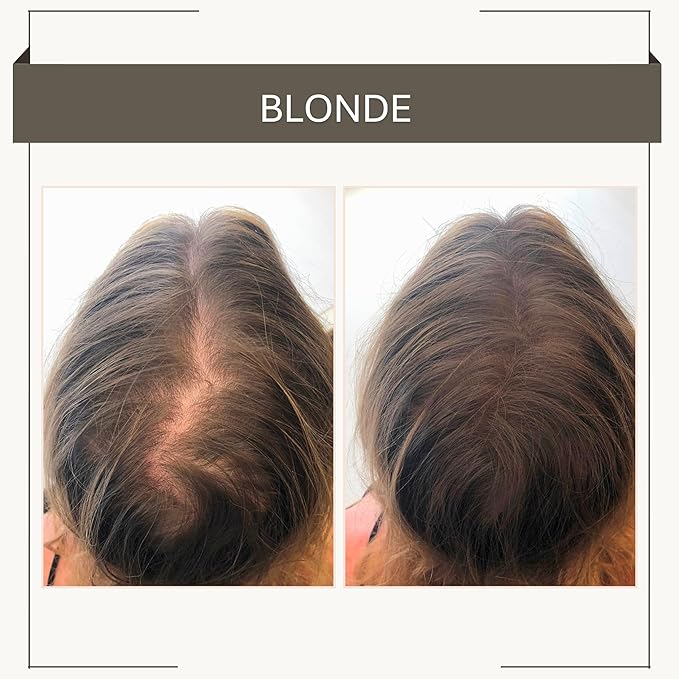 Joan Rivers Great Hair Day Root Touch Up Powder – Fill-in Powder for Thicker, Fuller Looking Hair (Blonde)