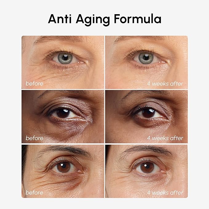 MAREE Under Eye Balm Stick with Retinol & Ceramide Complex - Facial Moisturizer for Dark Circles & Wrinkles - Under Eye Brightener Stick, Anti Wrinkle Hydrating Face Skincare