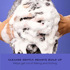 Shea Moisture Anti-Dandruff Shampoo Apple Cider Vinegar & Salicylic Acid For Removing Buildup System For A Healthier Scalp 13 Oz