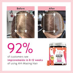 Biotin Gummies for Hair, Skin & Nails. 5,000 mcg High Potency Vegan Vitamins for Faster Hair Growth, Stronger Nails & Healthy Skin. with Vitamins C & E, 90 Gummies