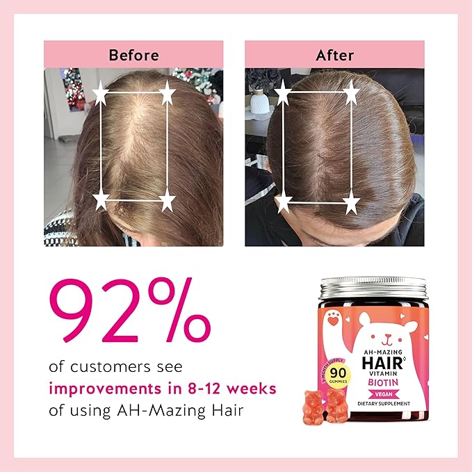 Biotin Gummies for Hair, Skin & Nails. 5,000 mcg High Potency Vegan Vitamins for Faster Hair Growth, Stronger Nails & Healthy Skin. with Vitamins C & E, 30 Gummies