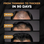 SPARTAN™ Root Activator Conditioner For Men - Hair Growth Conditioner, Thickening Hair Moisturizer for Hair Loss and Thinning Hair