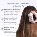 Complex10 Hair Support Supplement with Biotin, Collagen & 10 Essential Nutrients – Supports Healthy, Stronger-Looking Hair – 30 Capsules for Men & Women