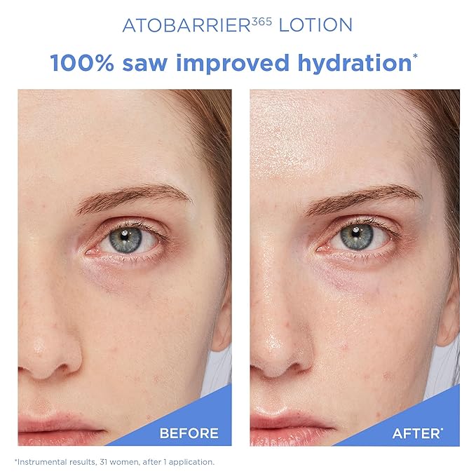 AESTURA ATOBARRIER365 Face Cream + Lightweight Lotion