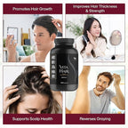 Vita Hair (Micronized Formula) Growth & Hair Loss Supplement – 100% Natural for Healthier Hair – Supports Hair Growth, Reduces Hair Loss, and Combats Graying for Men & Women – 300 Capsules
