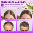 5% Minoxidil for Men and Women Hair Growth Products, Biotin Serum with Rosemary for Hair Regrowth Treatment, Minoxidil Spray Extra Strength Hair Loss Solution, Clinically Proven to Regrow Thicker