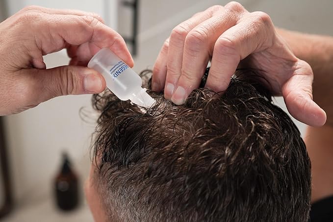 Regenix Starter Kit to Treat Hair Loss 30 Day Supply, Shampoo + Deep Follicle Cleanser + Essential Scalp Protectant + Treatment Vials, Free Hair Microanalysis