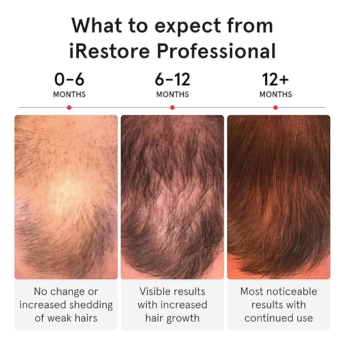 iRestore Professional Laser Red Light Therapy for Hair Growth System - FDA Cleared Hair Loss, Hair Thinning & Alopecia Treatment for Men & Women - 282 Lasers & LEDs
