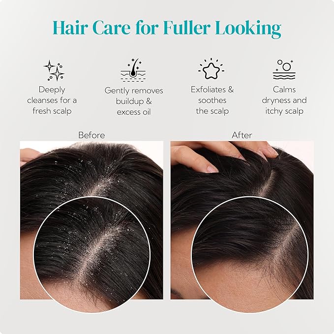 HEETA Scalp Massager 2 Pack for Hair Growth, Soft Silicone Bristles to Remove Dandruff and Relieve Itching, Scalp Scrubber for Hair Care Relax, Shampoo Brush for Wet Dry Use, New Grey & Beige