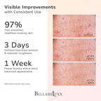 Butt Acne Clearing Set: Butt Acne Lotion + Acne Soap + Body Acne Scrub for Breakouts on Butt, Thighs, Back & Chest, KP Bumps, Clogged Pores & Rough Buttocks – Exfoliate, Cleanse & Smooth