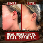 Organic Beef Tallow for Skin - 4 OZ (Vanilla) — Grass Fed Beef Tallow for face + Body — US-Made Whipped Tallow and Honey Balm Moisturizer for Dry and Sensitive Skin, Eczema, Rosacea (No Additives)