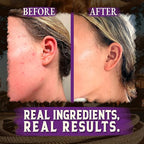 Organic Beef Tallow for Skin - 4 OZ (Lavender) — Grass Fed Beef Tallow for face + Body — US-Made Whipped Tallow and Honey Balm Moisturizer for Dry and Sensitive Skin, Eczema, Rosacea (No Additives)