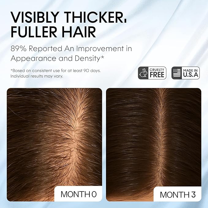 AM/PM Hair Growth Serums for Women & Men – Redensyl Capixyl Procapil GHK-CU Multi-Peptide & Stem Cell Formula| DHT Blocker Topicals | Regrowth Treatment | Hair Loss Support Bundle | Follicle Spray