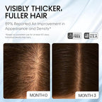 AM/PM Hair Growth Serums for Women & Men – Redensyl Capixyl Procapil GHK-CU Multi-Peptide & Stem Cell Formula| DHT Blocker Topicals | Regrowth Treatment | Hair Loss Support Bundle | Follicle Spray