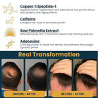 Copper Peptide Serum for Hair Growth - Caffeine, Niacinamide, Rosemary Oil, Saw Palmetto Hair Density Serum, Topical Tripeptide Scalp Care for Hair Thinning, Women & Men 1 fl oz