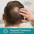 Minoxidil for Men Foam 5% - Unscented 6 Month Supply - Helps Restore Vertex Hair Loss & Thinning - 5% Minoxidil Foam For Men - Extra Strength Supports Hair Regrowth