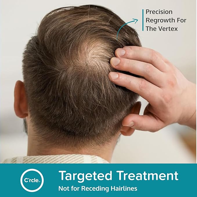 Minoxidil for Men Foam 5% - Unscented 6 Month Supply - Helps Restore Vertex Hair Loss & Thinning - 5% Minoxidil Foam For Men - Extra Strength Supports Hair Regrowth