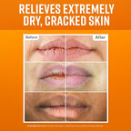 O'Keeffe's Lip Repair Lip Balm Set for Dry, Cracked Lips - Stick (Pack of 3: 1 Cooling + 1 Unscented + 1 SPF) - Moisturizer for for Extremely Cracked, Dry Lips