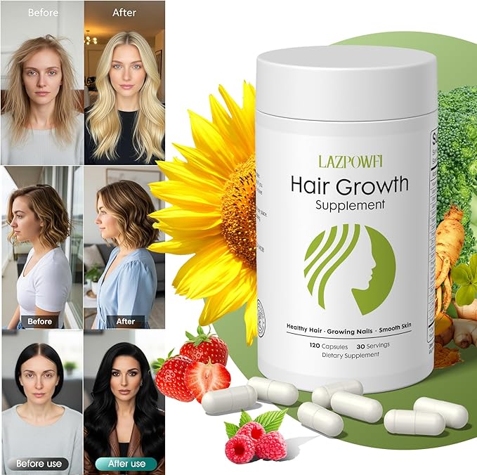 Hair Growth Supplement, Biotin 10000mcg, 32-in-1 with Vitamin A, B3, C, Magnesium, Calcium, Hair Growth Products, Supports Hair & Nails Natural Growth Vitamins, for Women & Men - 30 Servings