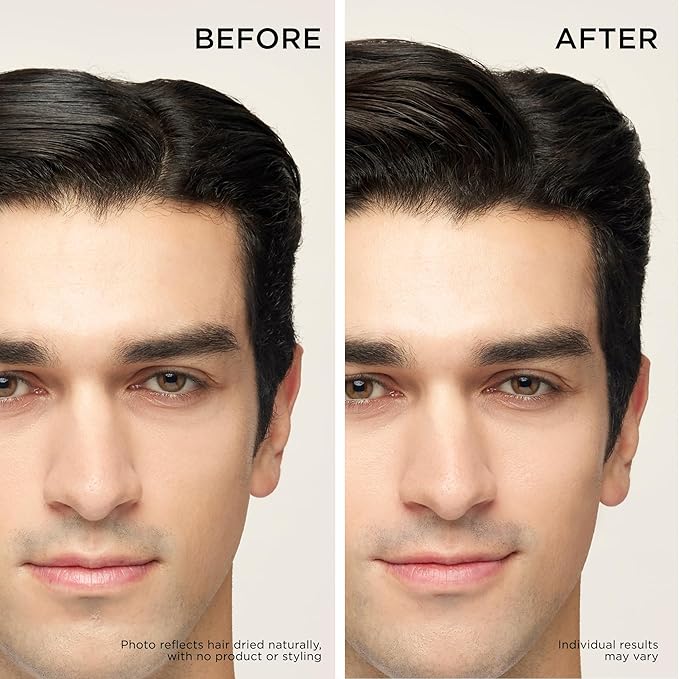 Dr. Groot Thickening Shampoo & Scalp Treatment Set for Hair Loss – Clinical Results with Biotin and Rosemary for Hair Thinning, Shedding, Scalp Repair and Treatment